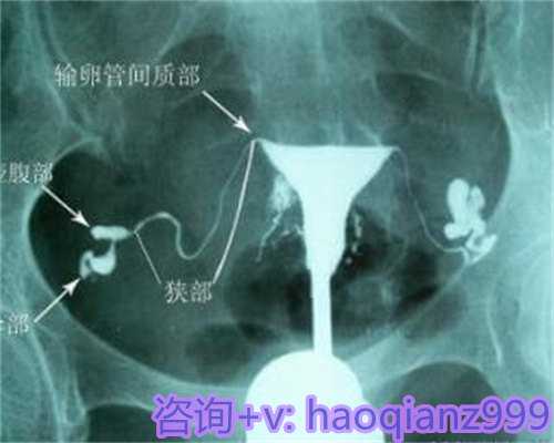 西安代生医院指南：捐卵与供卵选择解析